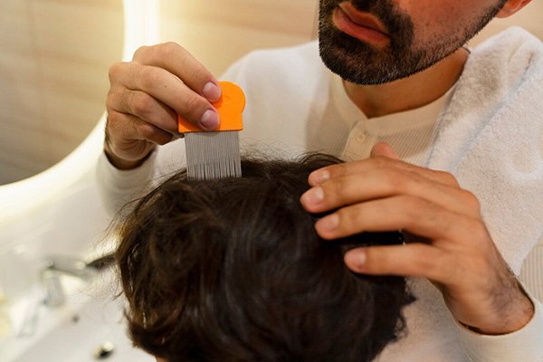 Ayurvedic Hair Loss Treatment