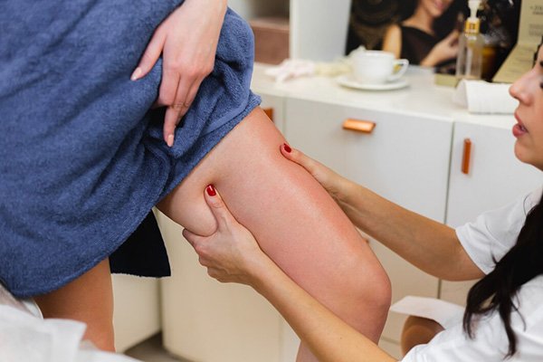 Varicose Veins Treatment
